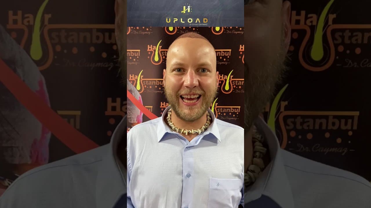 Mr.Zillgitt from USA/Denver - 4700 Graft | Hair Transplant 2021