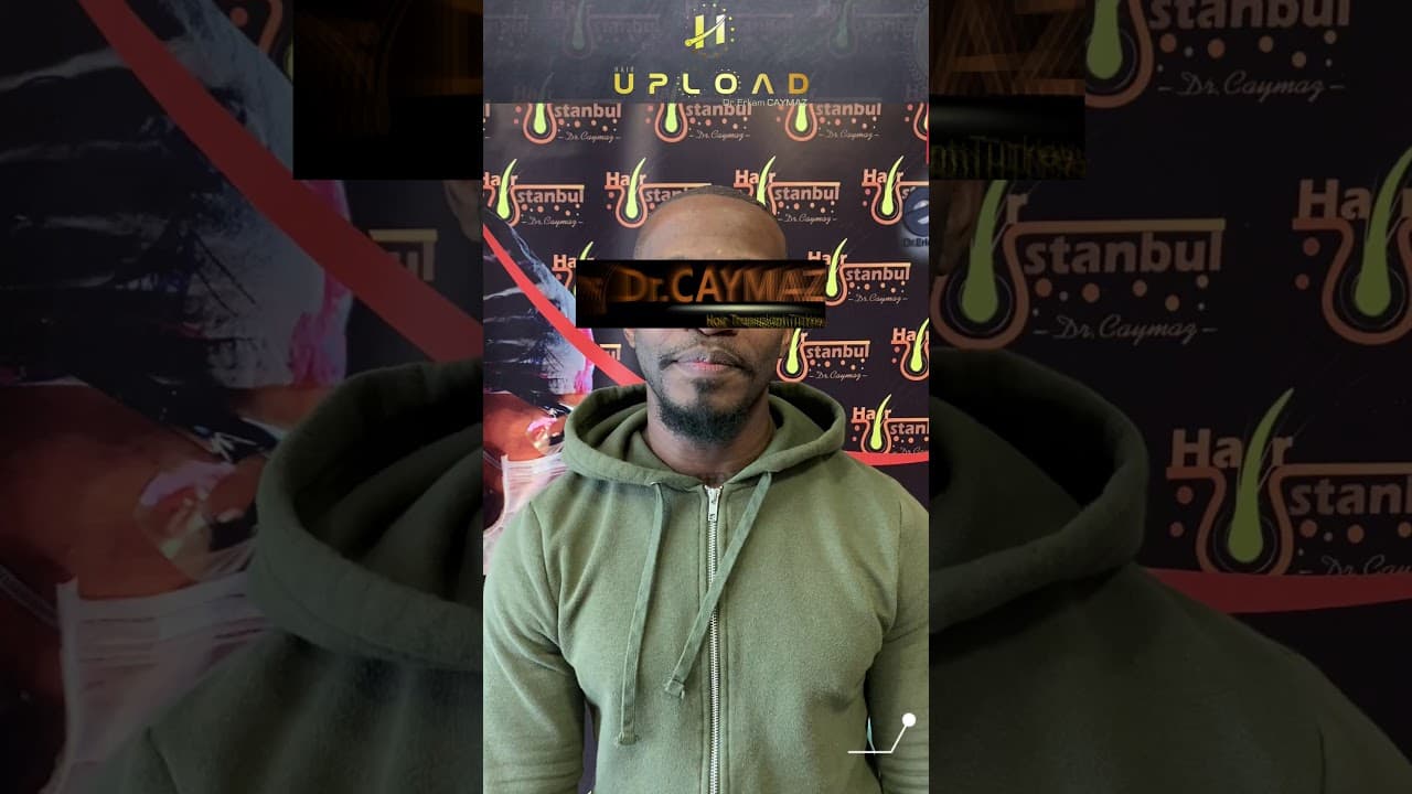 Mr Private - 3000 Graft USA | Hair Transplant 