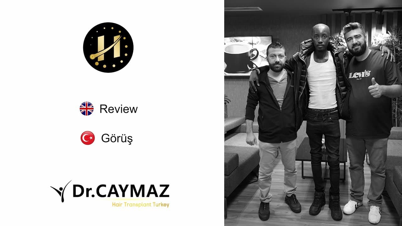 Mr Mamadou Afrotype 4500 Graft