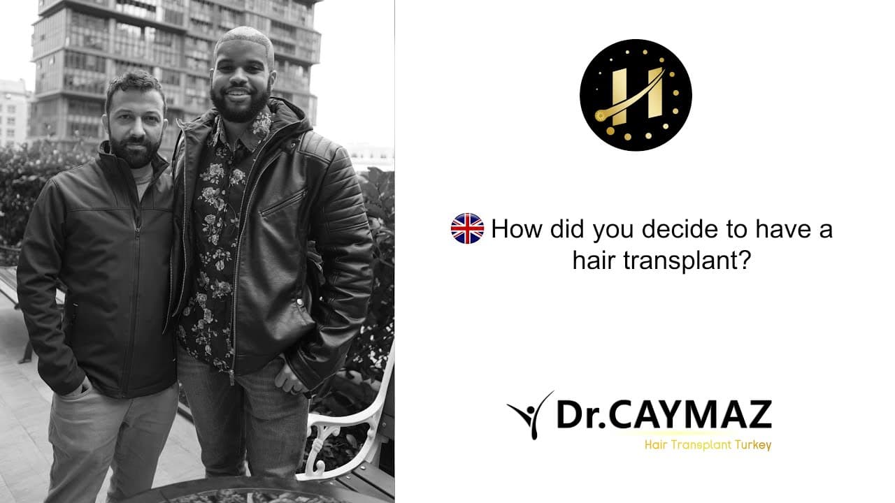 How did you decide for Hair Transplantation?