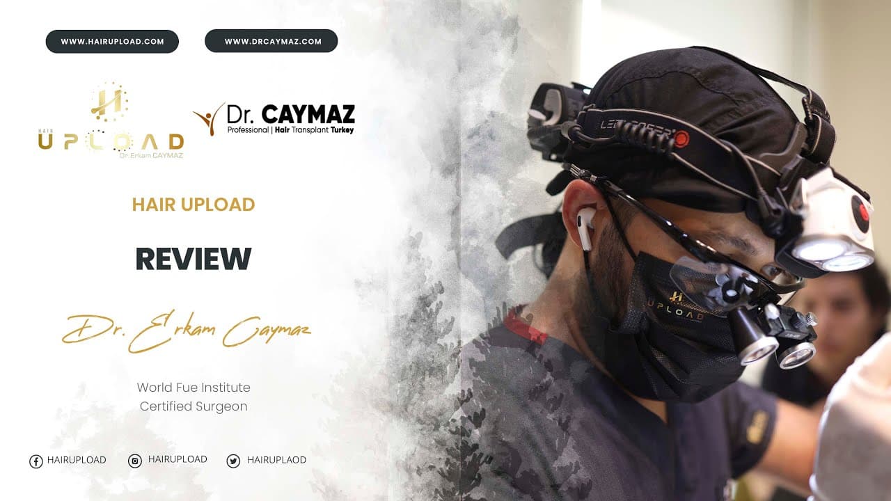 Sene Elhadjıb  | Sapphire FUE | 2800 Graft | USA - Hair Transplant