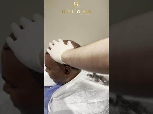 Hairline Designing and Hair Shave