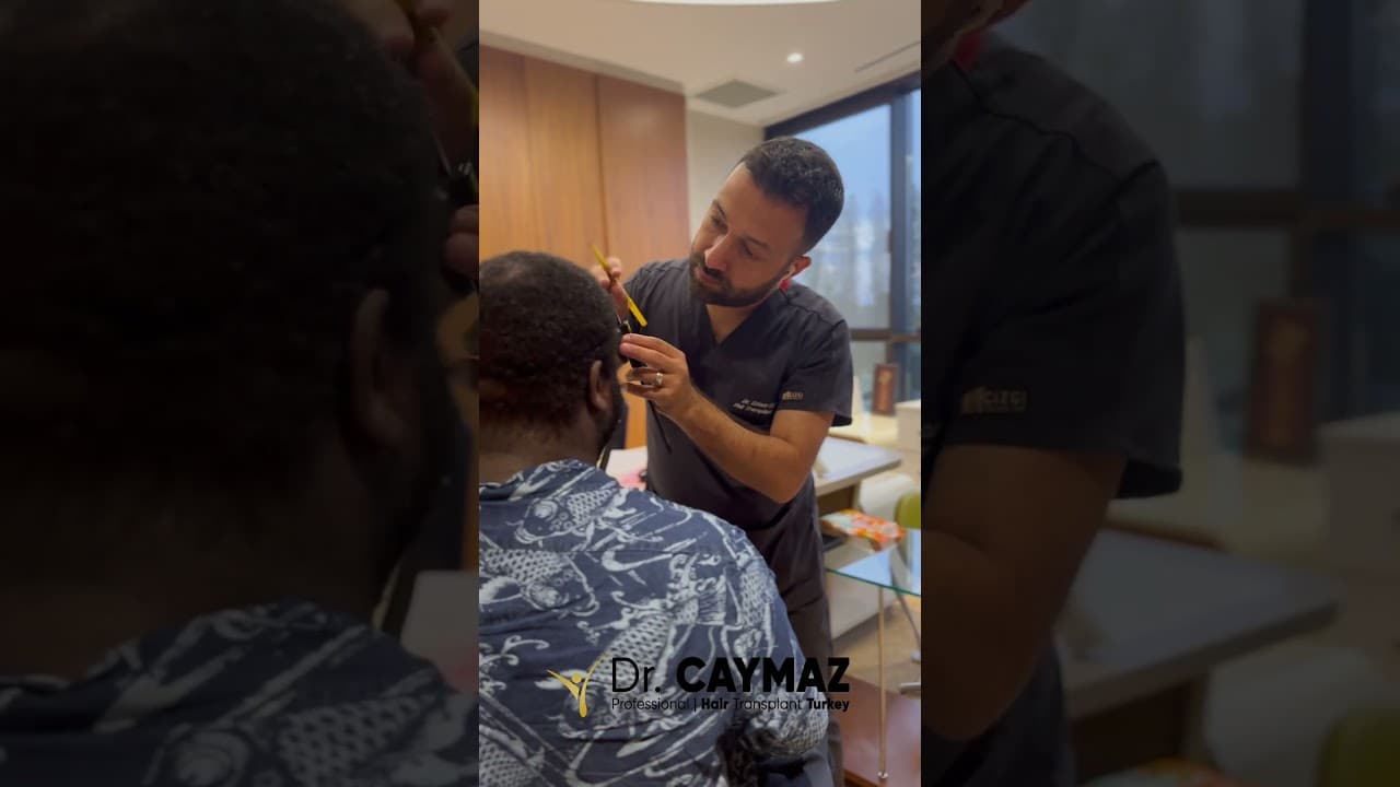 Hairline creating by Dr. Caymaz
