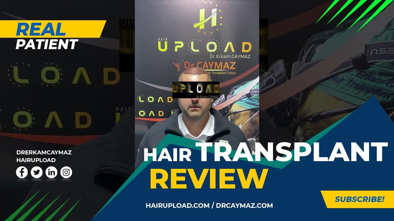 Mr Private USA - 5000 Graft - Hair Upload Clinic - Hair Transplant in Istanbul Review | Dr.Erkam