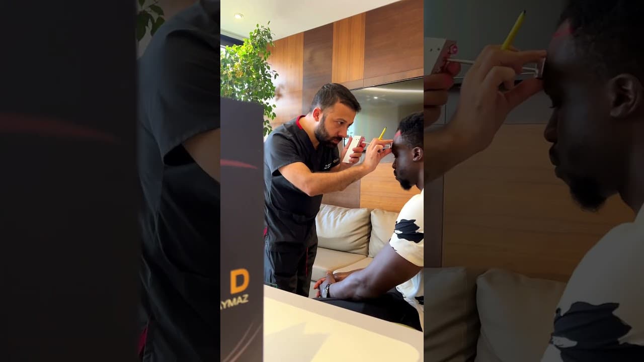 Best Afro Hair Transplantation in Istanbul by Dr. CAYMAZ