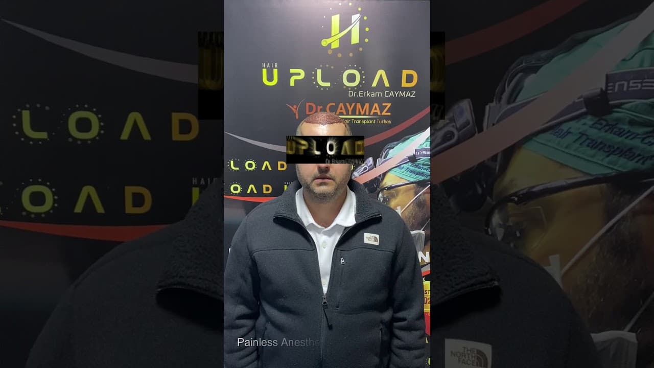 Mr Private from USA - 5000 Graft  - Hair Upload Clinic - Hair Transplant in Istanbul Review