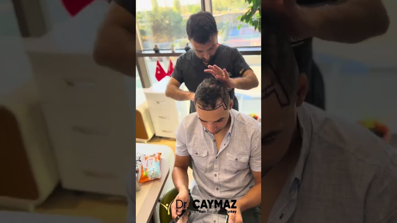 Hairline Designing by Dr.CAYMAZ