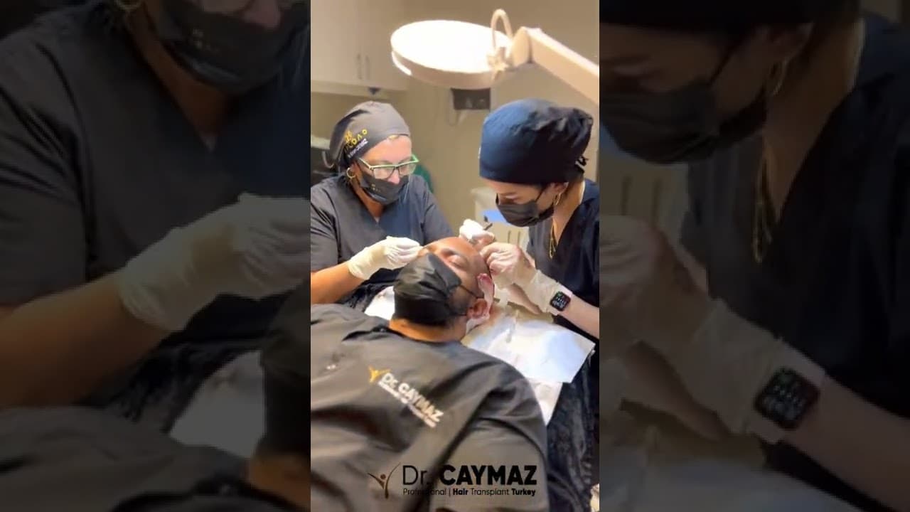 Hair Upload Hair Transplantation in Turkey