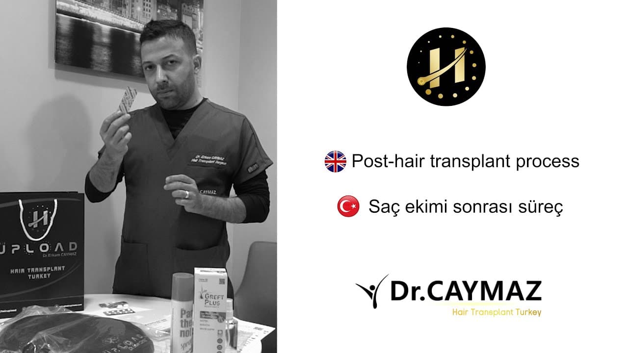 Post hair transplant process