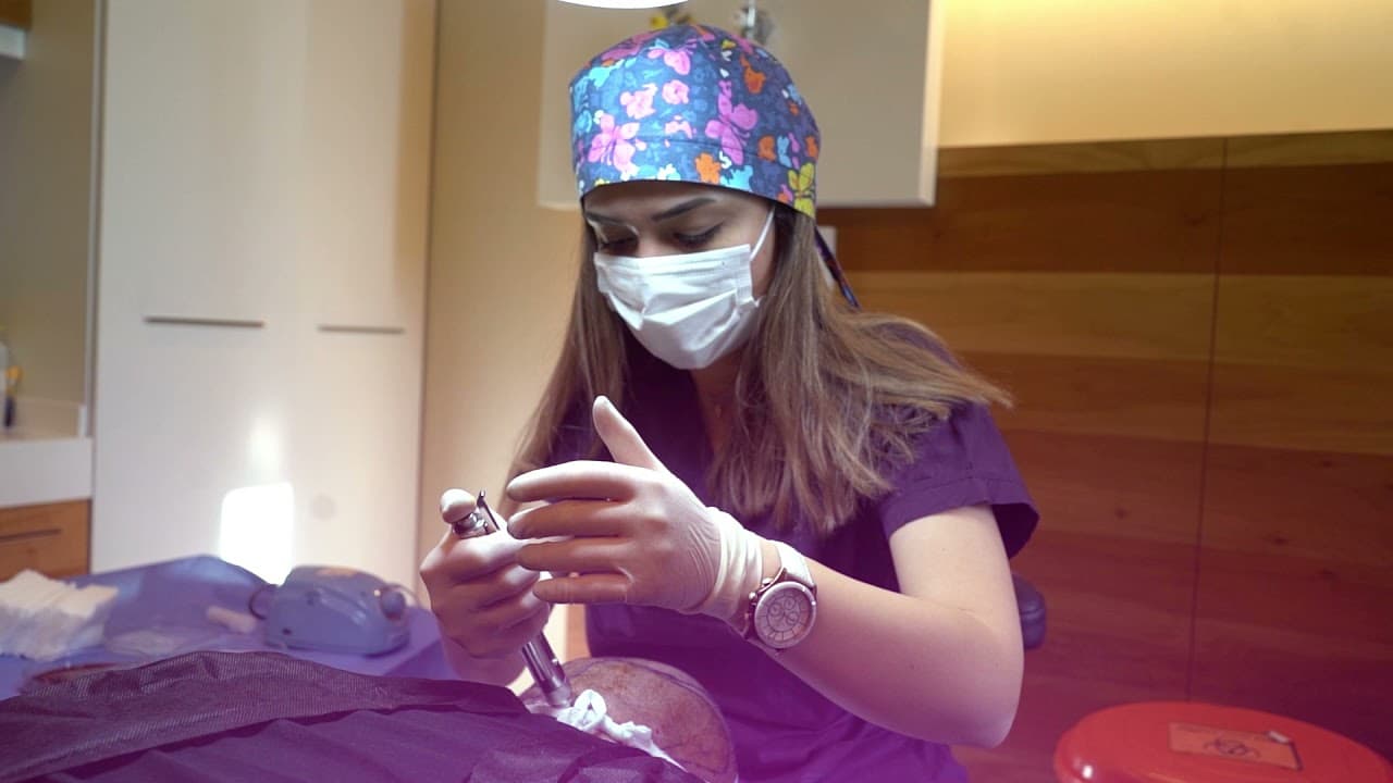 Vip Hair Transplantation in Turkey by Dr. Erkam CAYMAZ