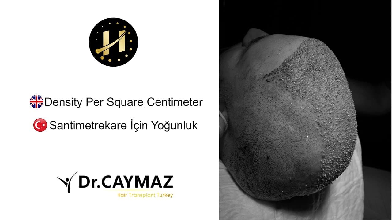 How many Centimeters is a Square of Hair?