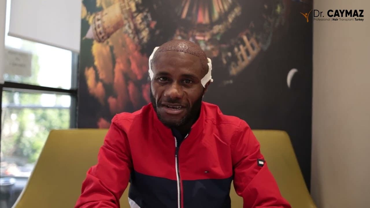 Christopher Sieh | Sapphire FUE | 3200 Graft | Australia Hair Transplant