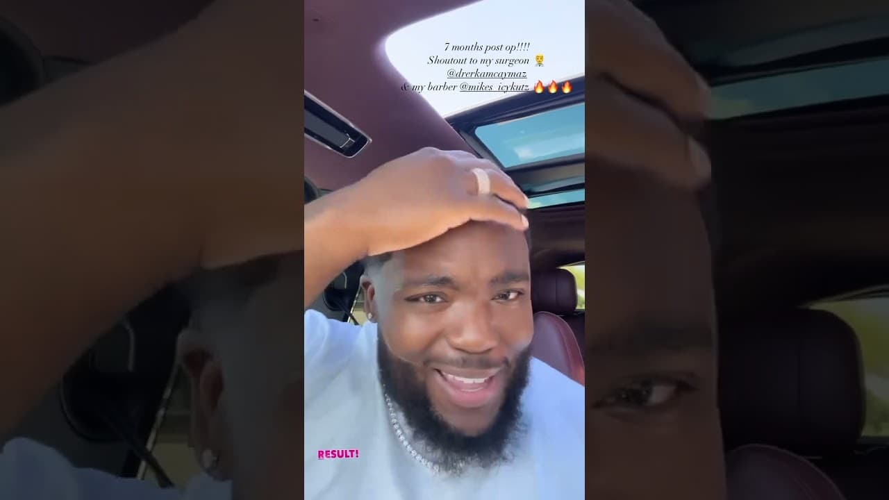 7 Month Afro American Hair Result by Dr.CAYMAZ