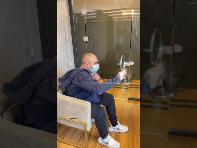 Hairline Desing by Dr Caymaz