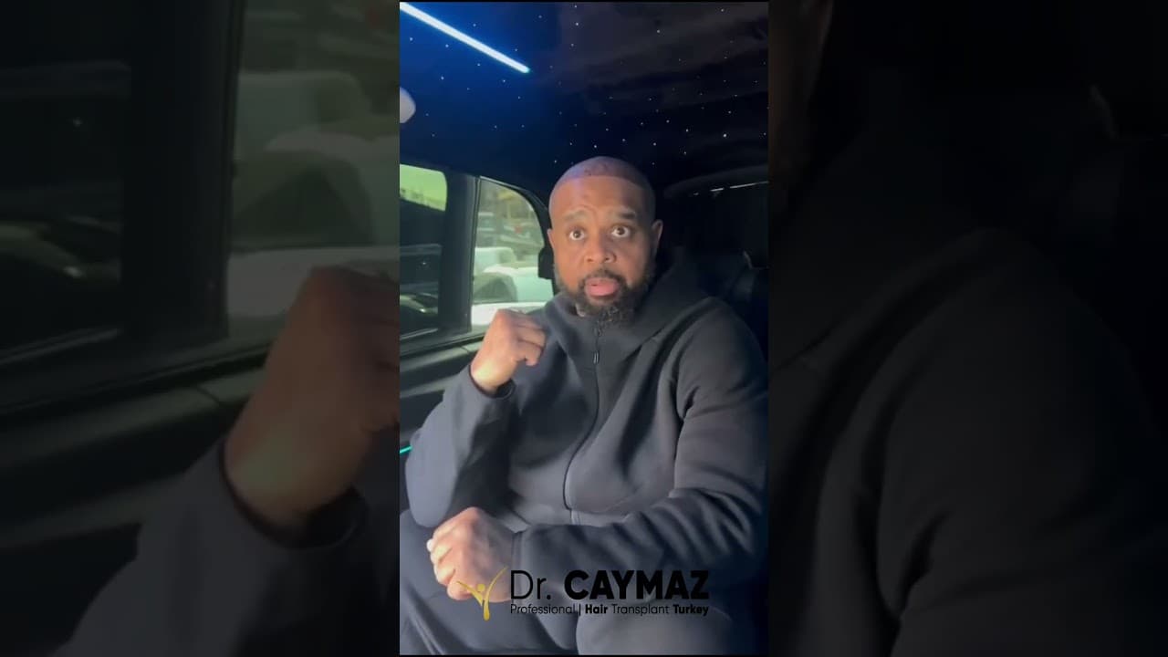 Afro Hair transplant Review