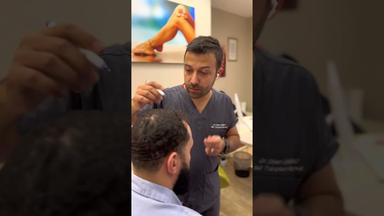 Hair Transplant Hairline Design by Doctor