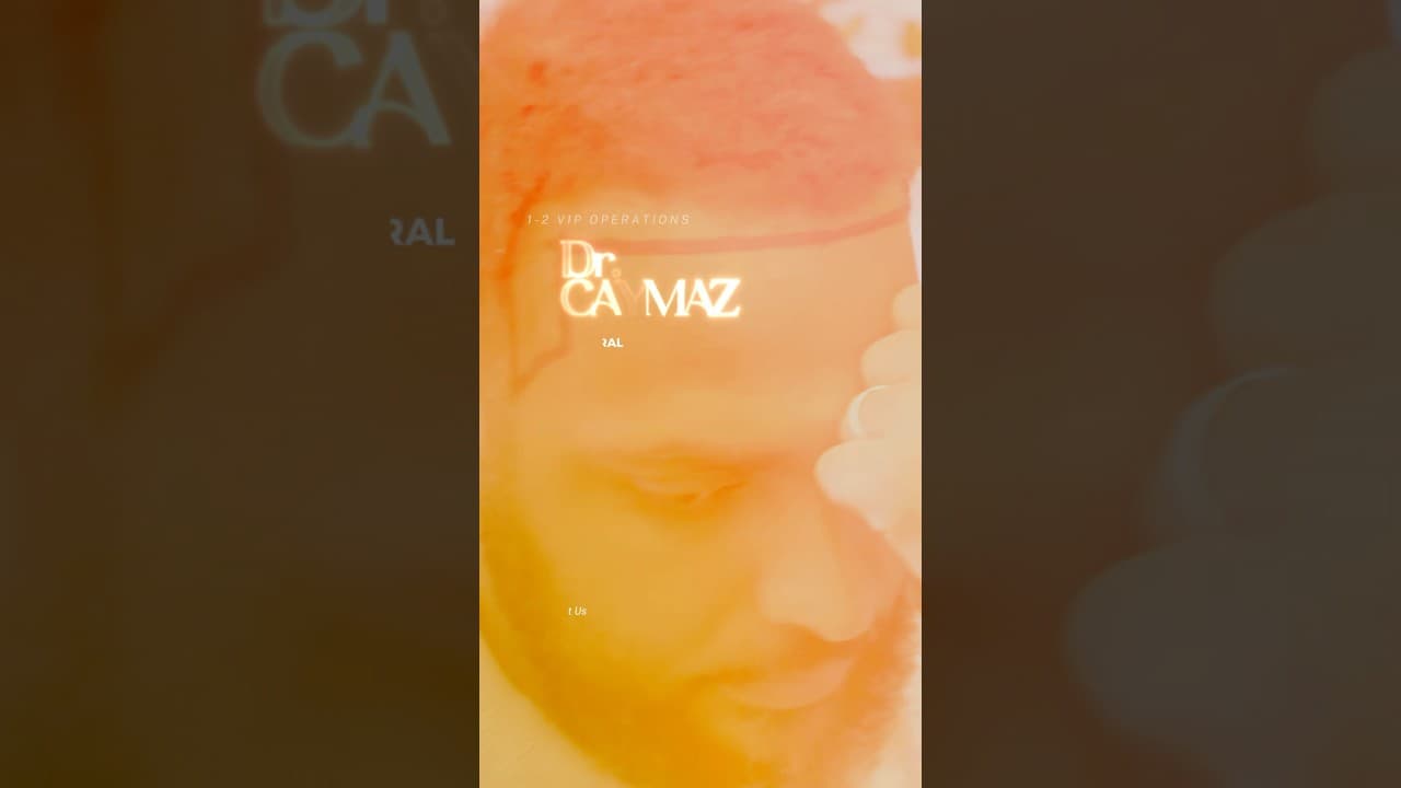 Best Hair Transplant