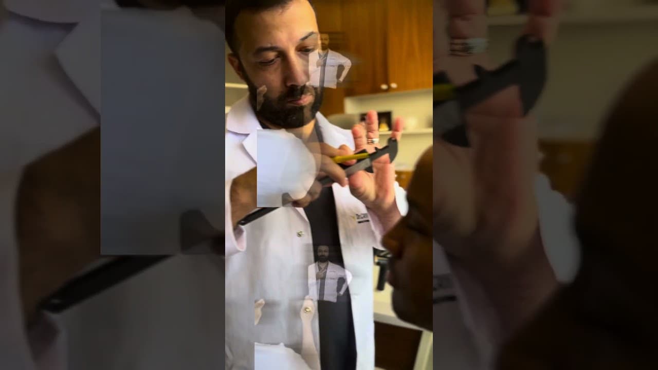 Hair Transplantation by Dr CAYMAZ #hairtransplant #hairdoctor #hairtransplantdoctor #besthairsurgeon