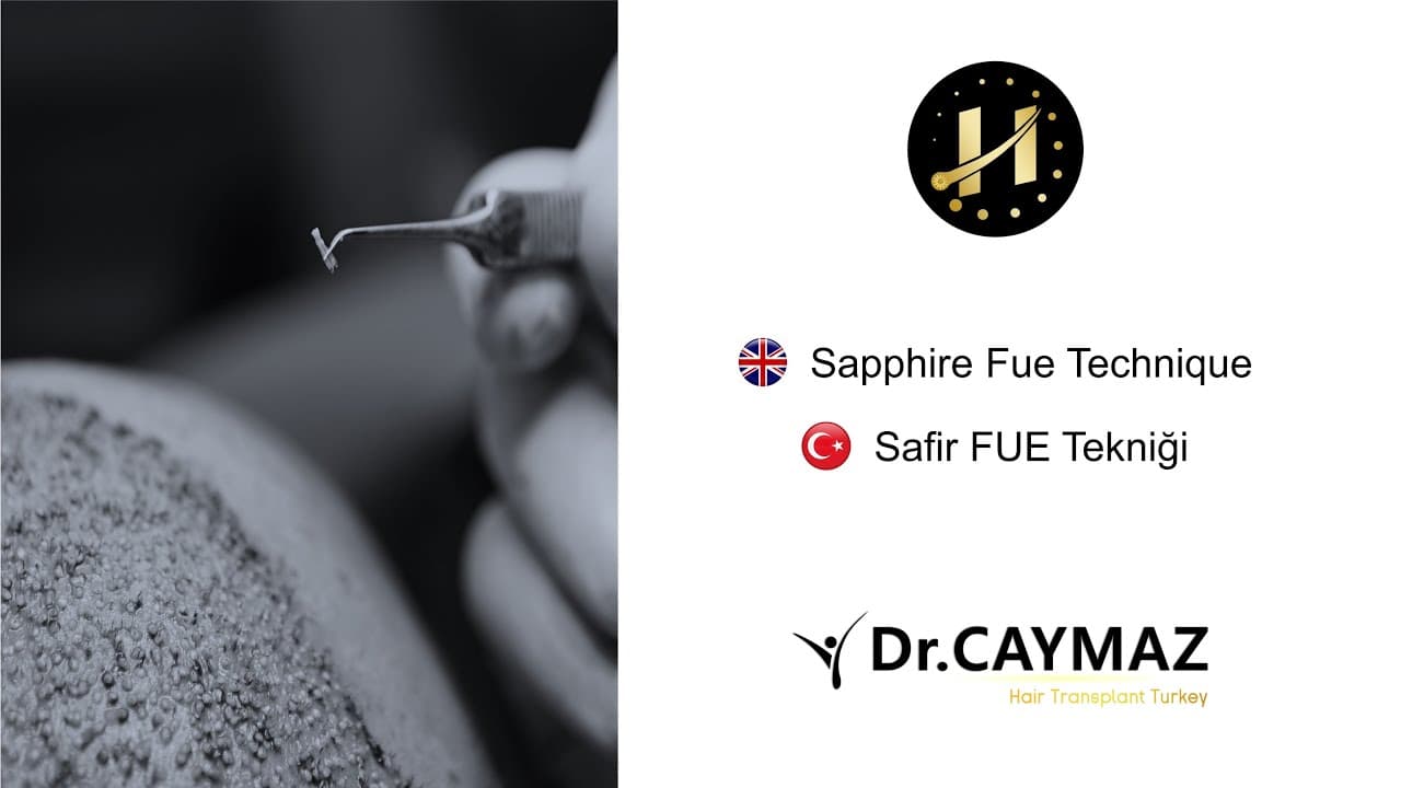 Sapphire Fue Technique | Dr Erkam CAYMAZ - Hair Transplantation in Istanbul