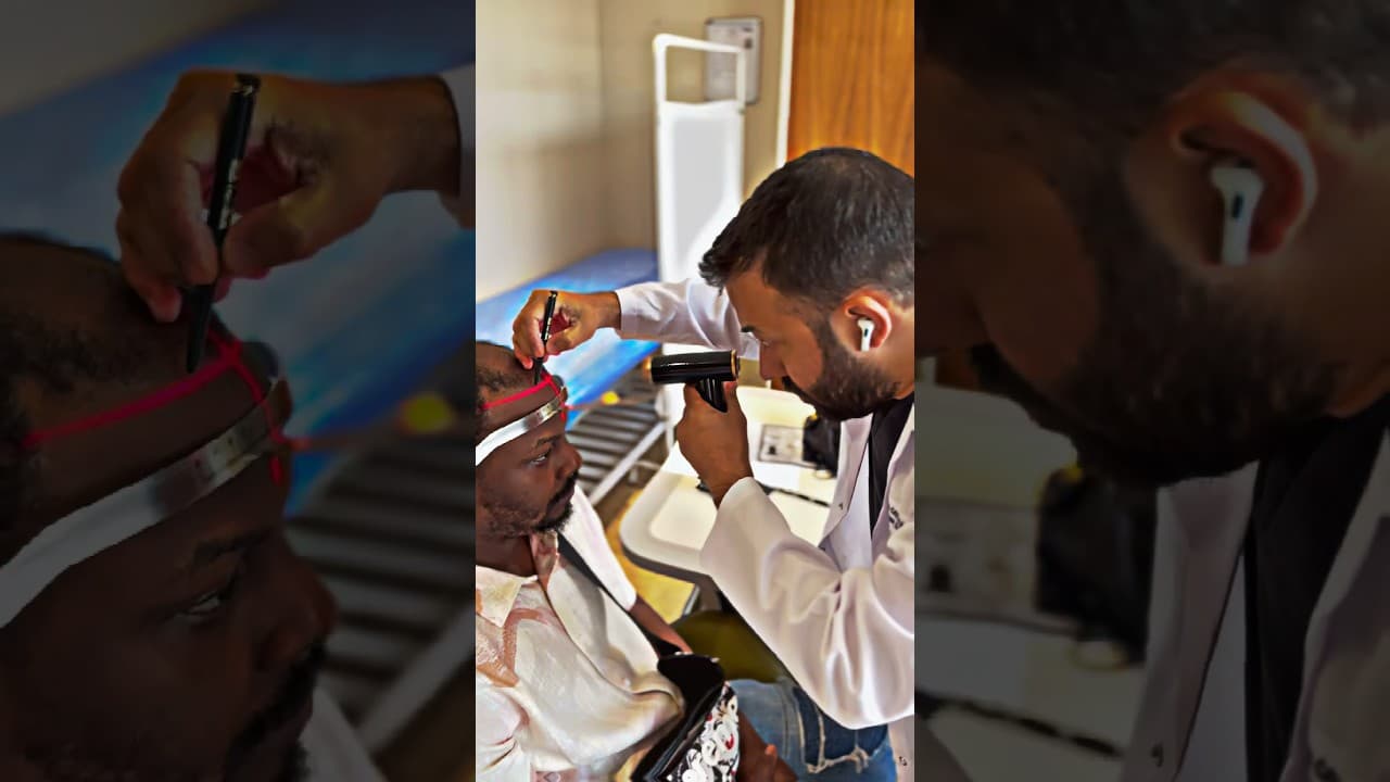 Best Hair Transplant Surgeon