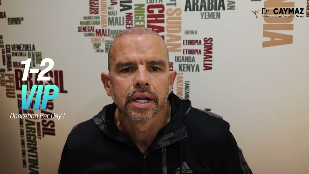 Gary MCCLAY | Sapphire FUE | 5000 Graft | USA - Hair Transplant