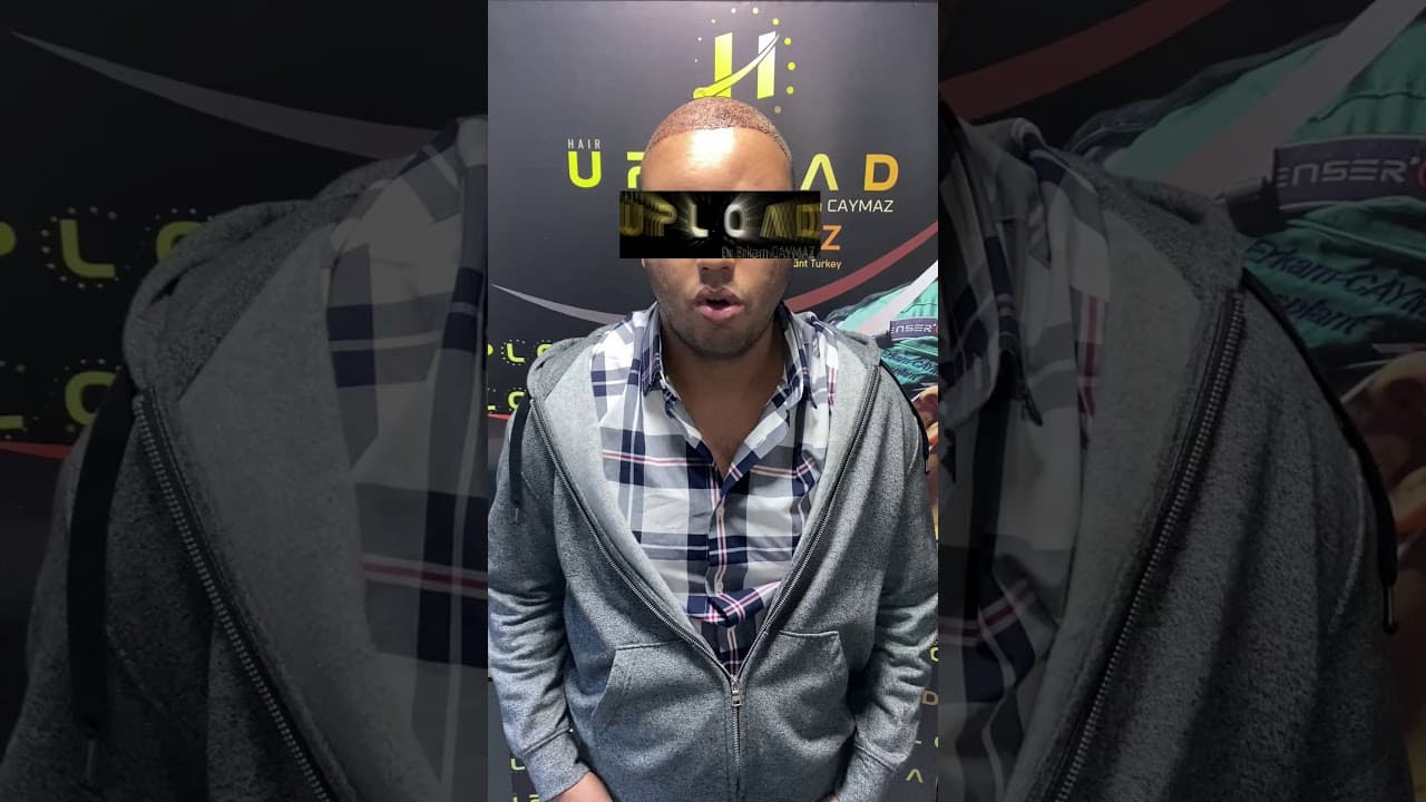 Mr Private - USA - 4000 Graft - Hair Upload Clinic - Hair Transplant in Istanbul Review | Dr.Erkam