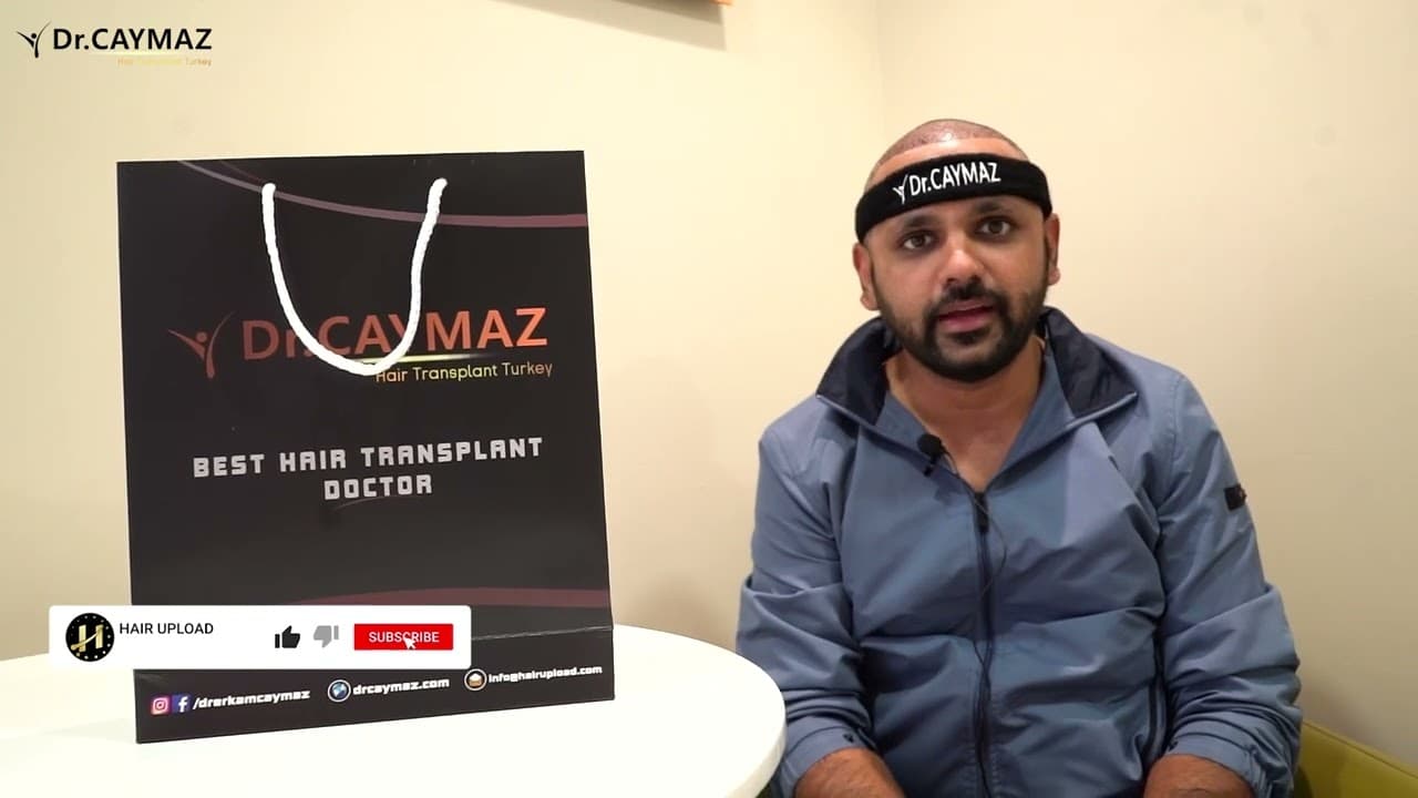 Hair Transplant Review from MR Shatir 2