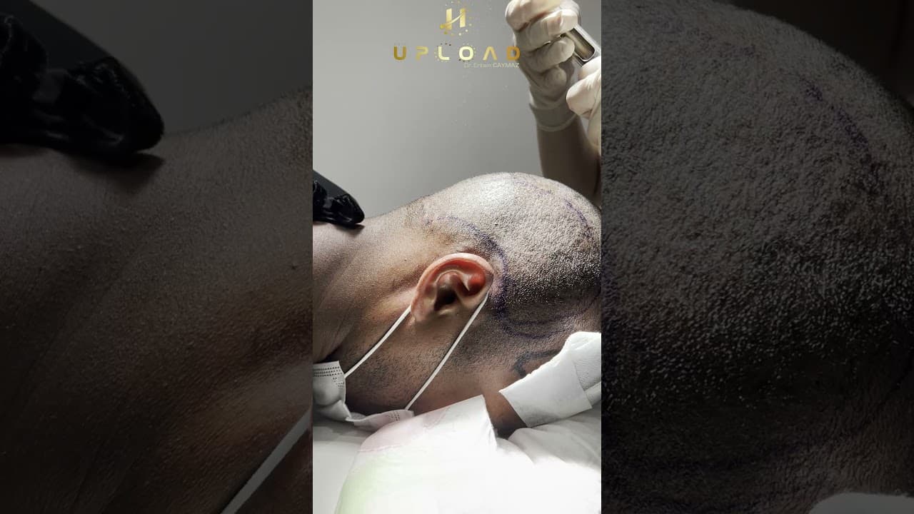 Hair Shaving and Painless Anesthesia