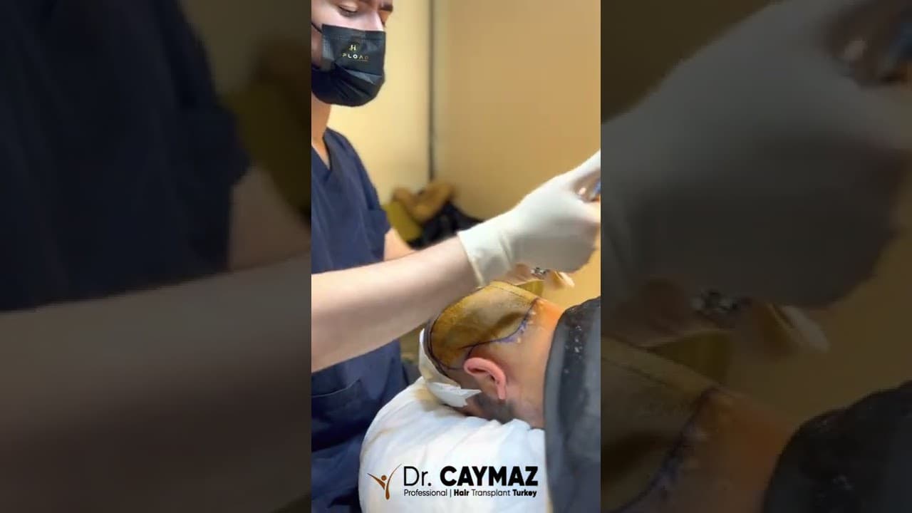 Needleless Anesthesia