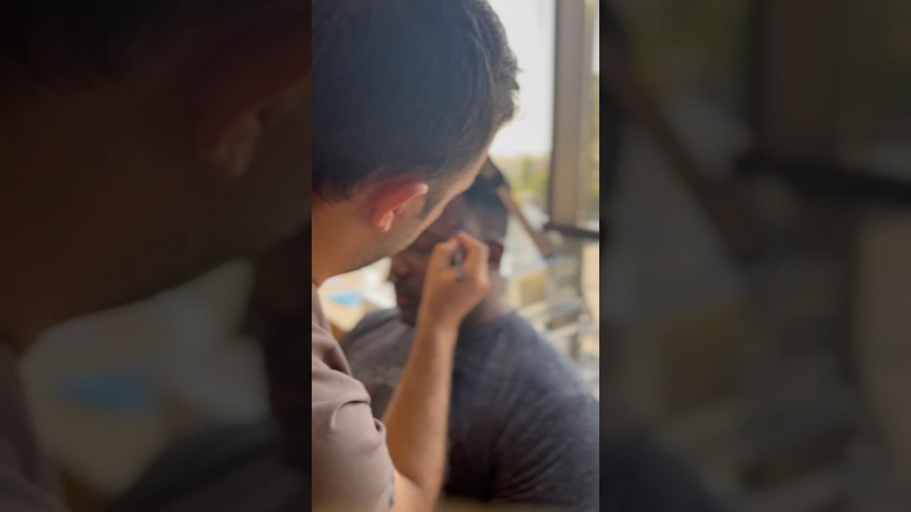 Best afro #hairtransplant