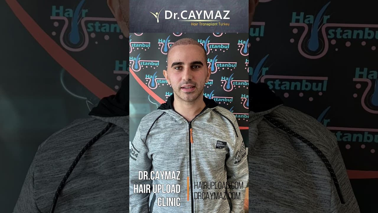 Mr VENHART from Serbia - 5500 Graft | Hair Transplant Review