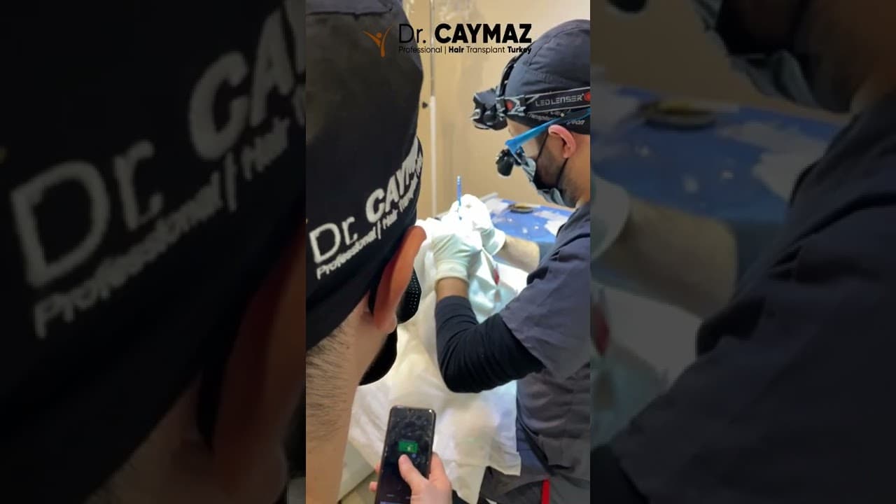 Dr Caymaz's Vip Hair Transplantation