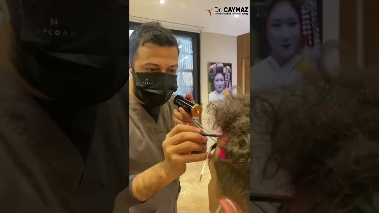 One day: Hair Transplantation in Turkey