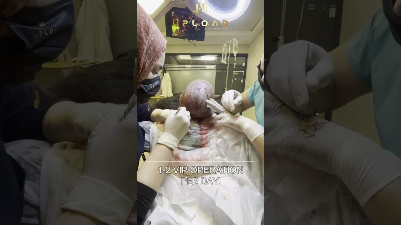 1 2 Vip Operation Per Day Hair Upload Clinic in Istanbul