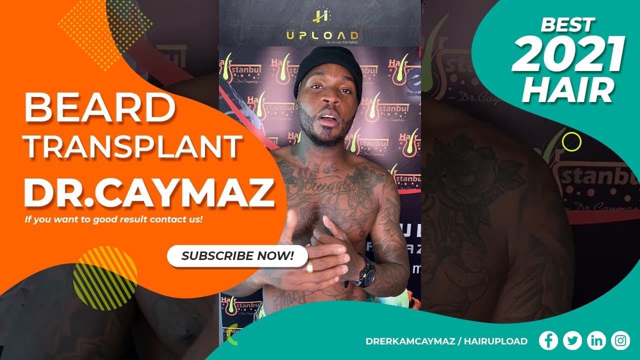 Mr.Axel from Belgium - 3500 Graft | Beard Transplant 2021