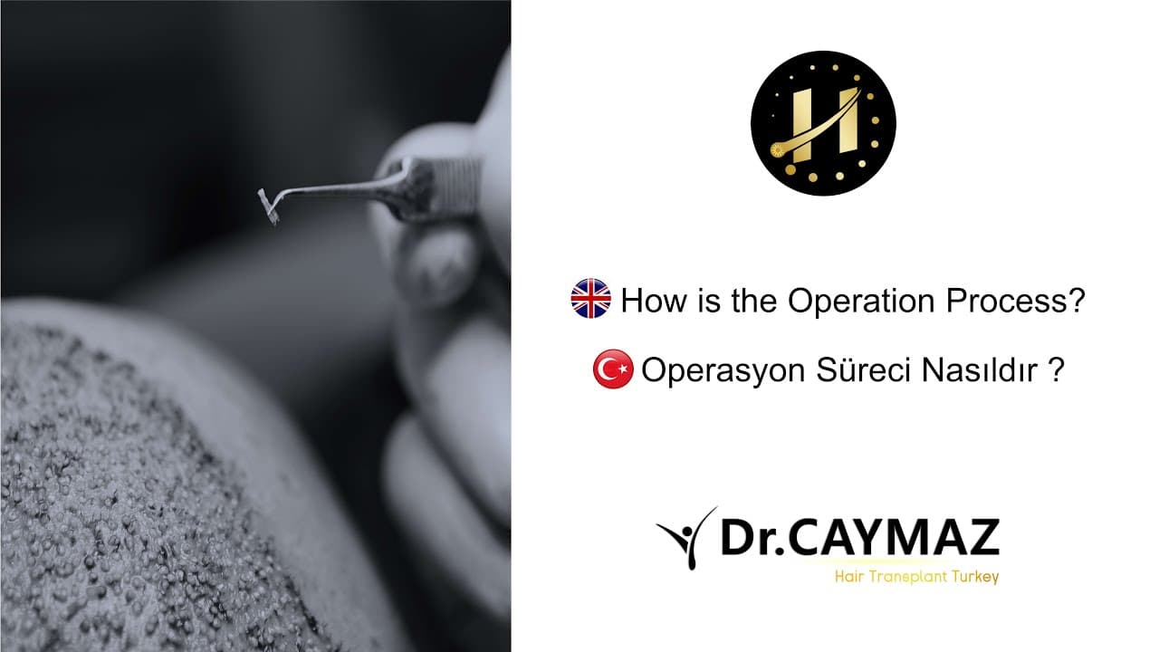 How is the Operation Process