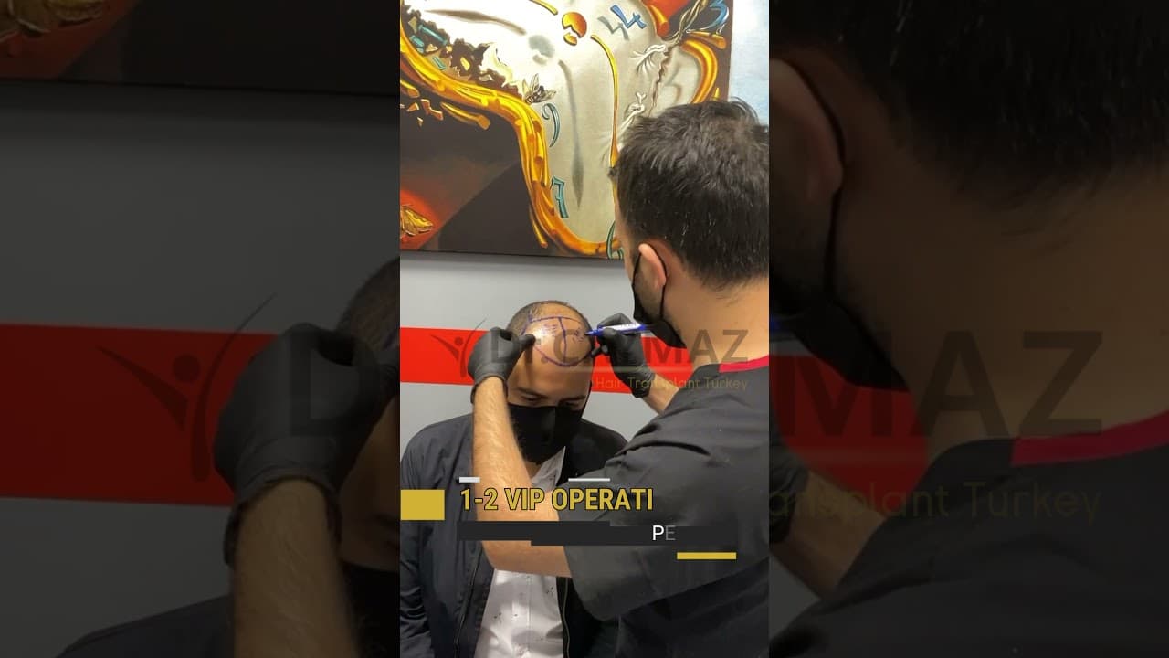Hairline Design with Laser and Process