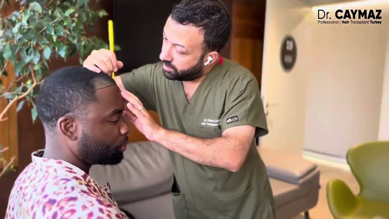 Best Hair Transplantation