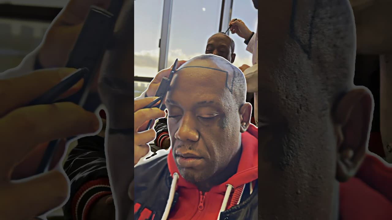 Hairline Design by Doctor Caymaz