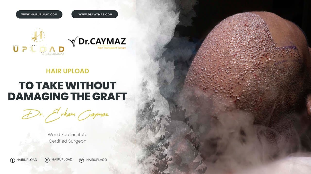 To Take Without Damaging The Graft  - Hair Transplant Turkey