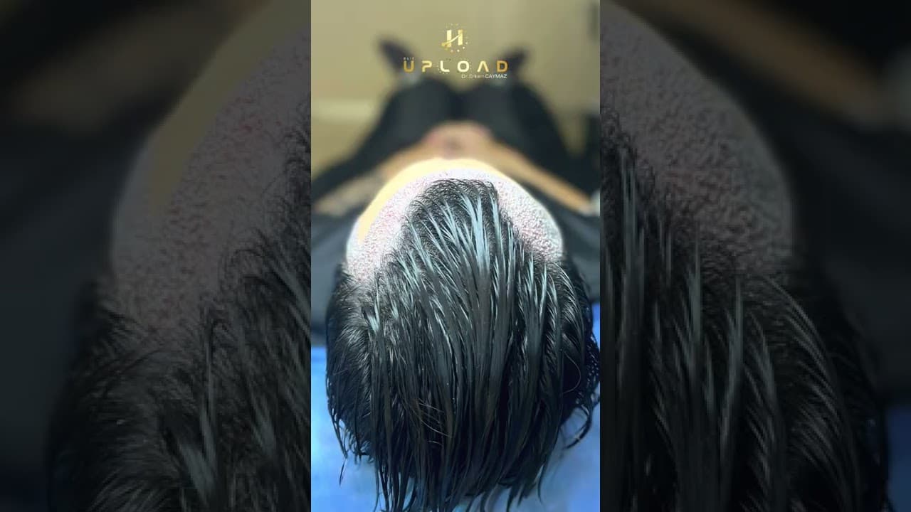 1 2 Vip Operations by Dr.CAYMAZ