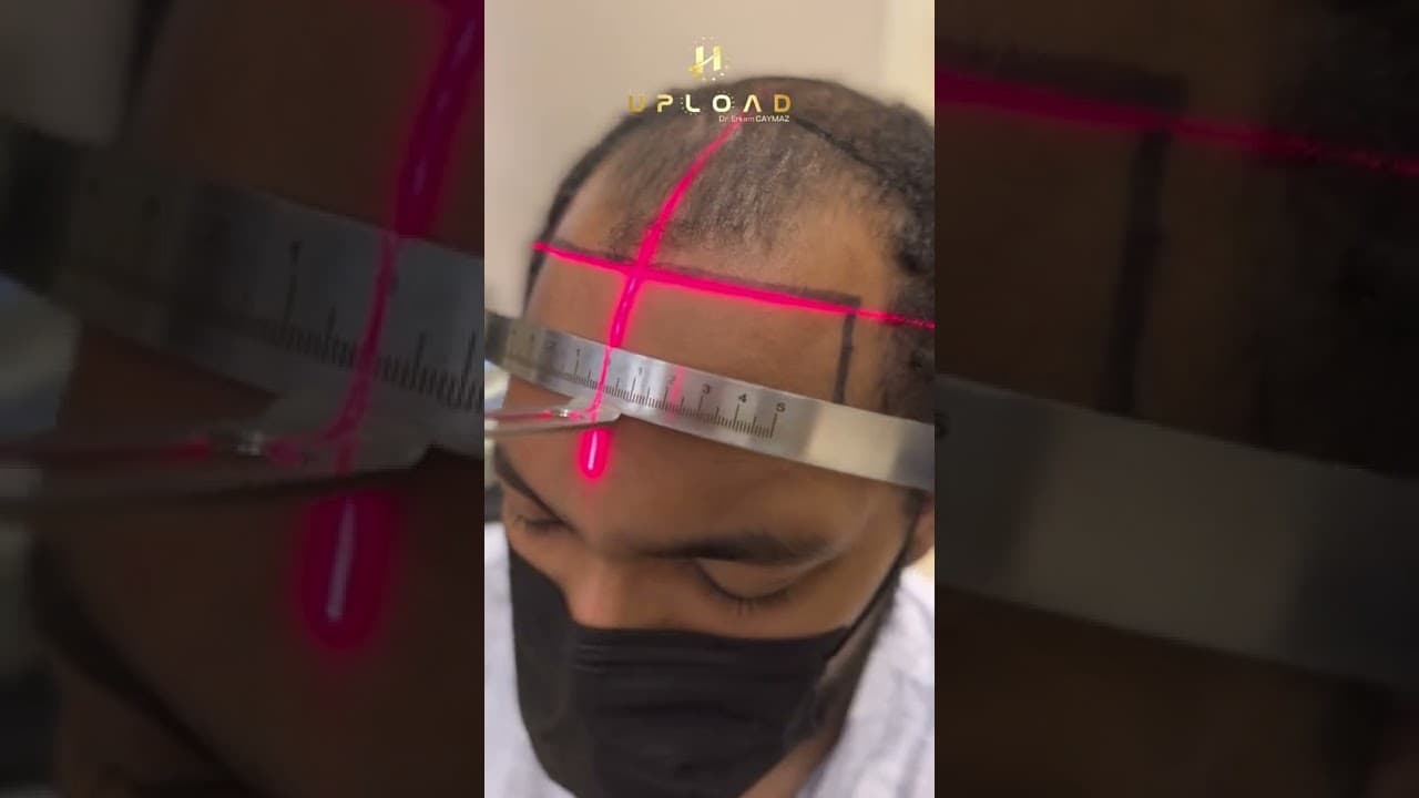 Hairline Designing Afro-American