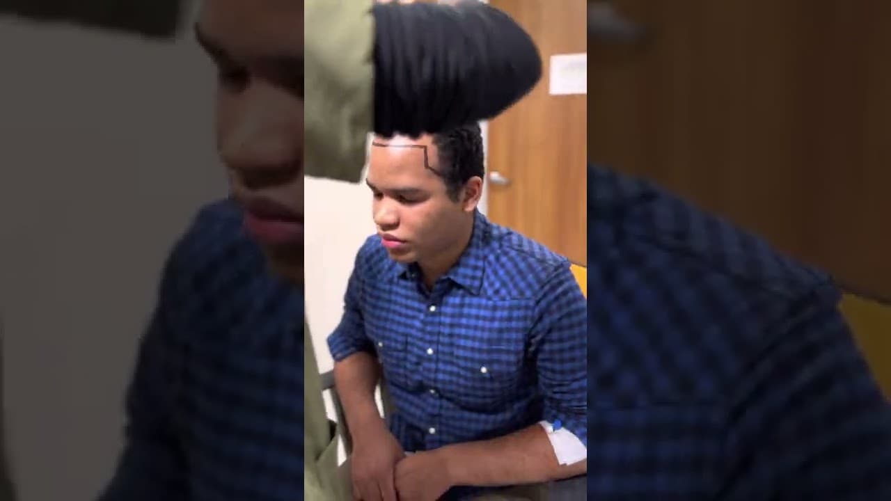 Vip Hairline Design by Doctor