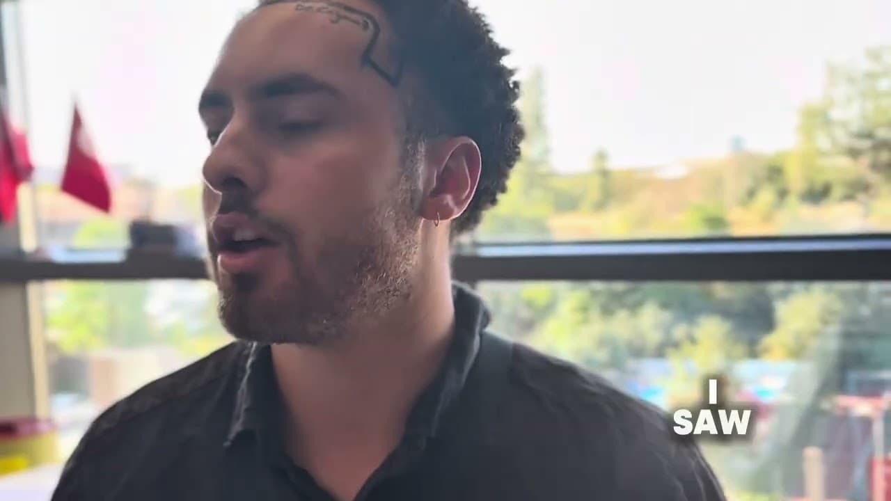 Hair Transplantation #sapphirehairtransplant