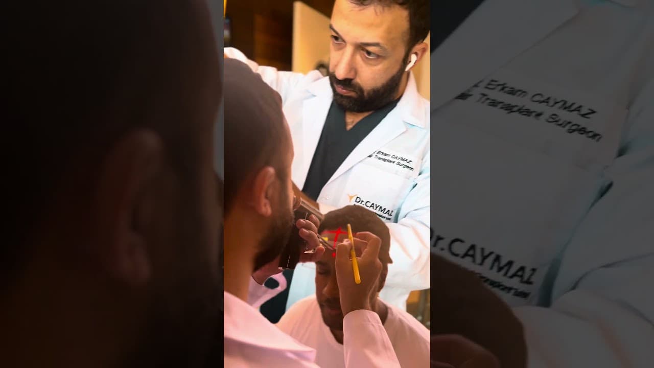 Hair Transplant Doctor #hairtransplant #hairimplant