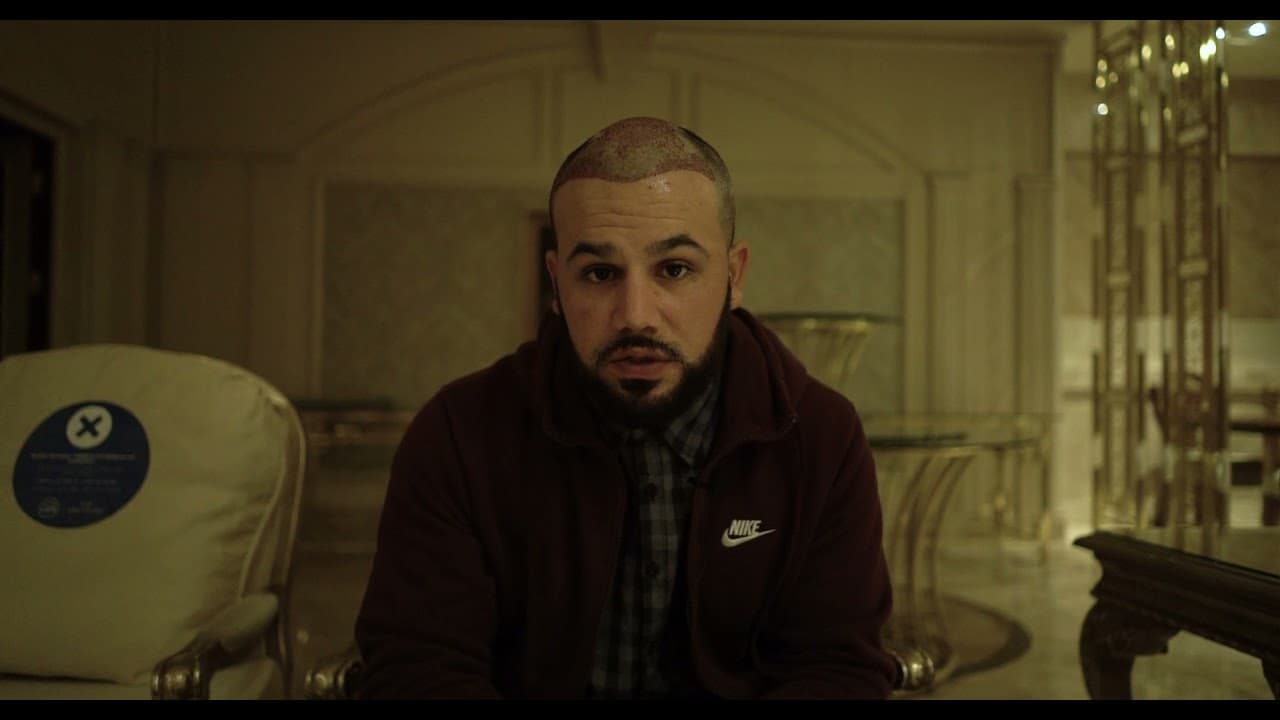 1 Vip Operation by Dr Caymaz in Hair Upload Hair Transplant Clinic | Turkey