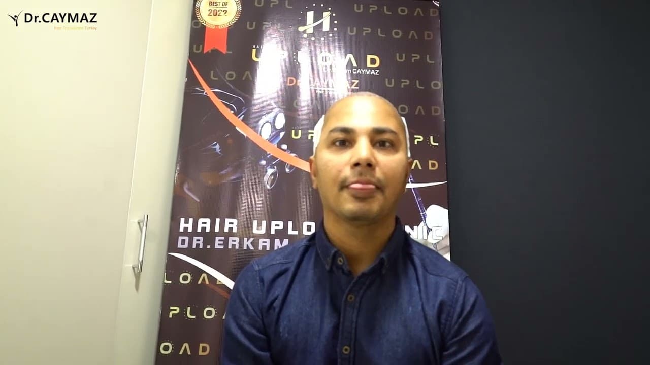 Hair Transplant from MR Shatir 4