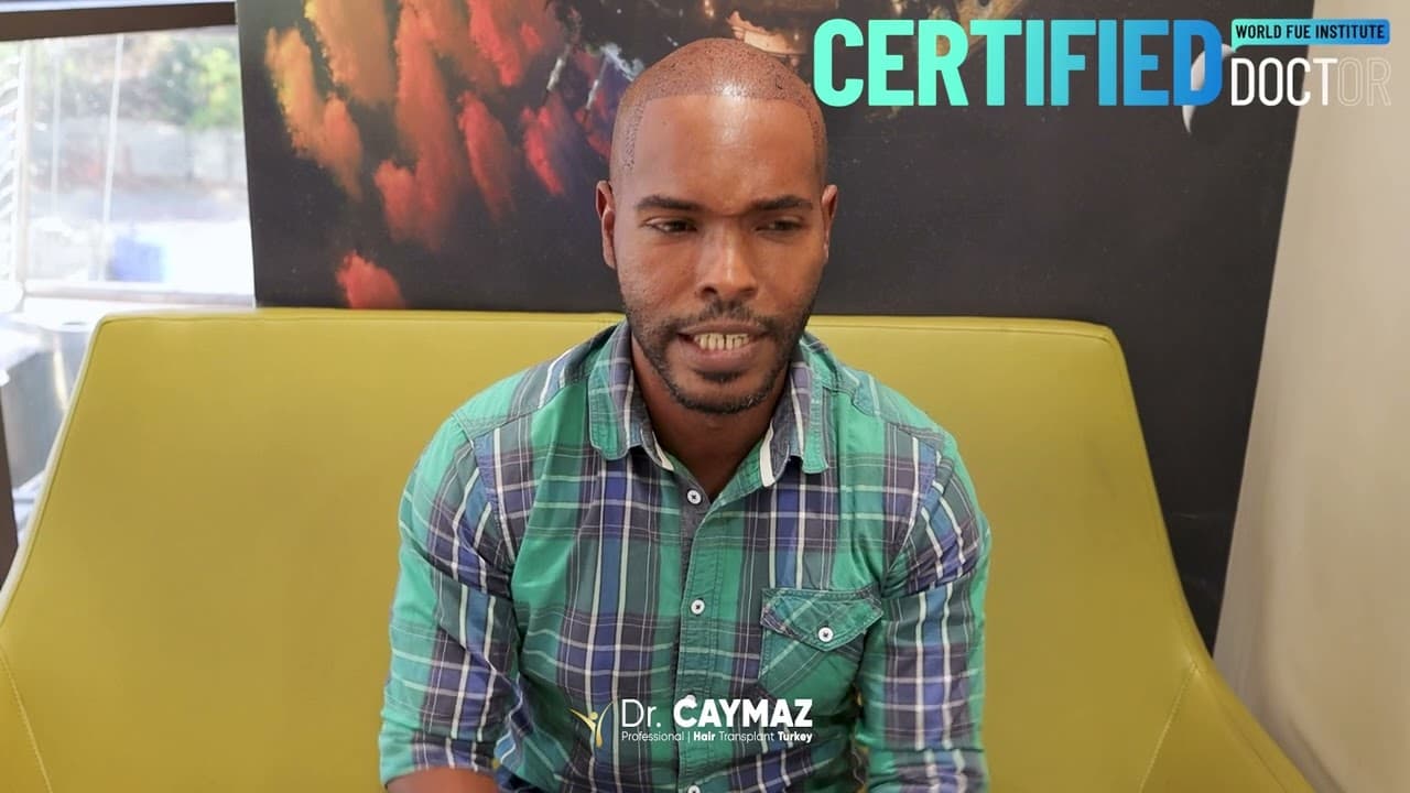 Dannys Jorge Martinez Herrera  | Sapphire FUE | 3500 Graft | Spain - Hair Transplant