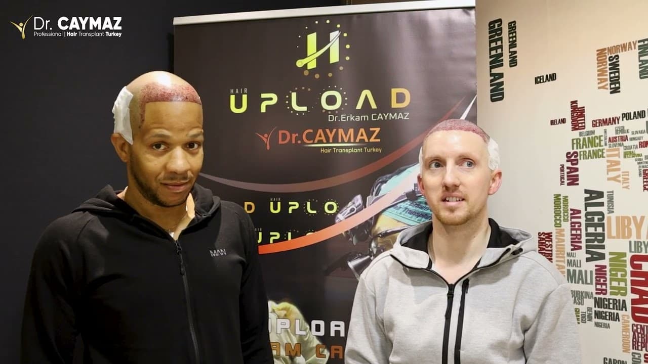 Wilbert Lee &  Kurt Daniel LEE - USA-Afro American Hair Transplant Review - Sapphire Blade Incision