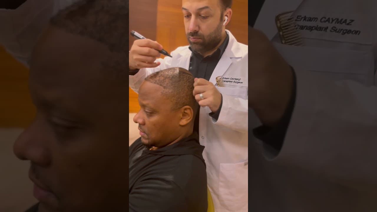 Afro Hairline by Dr.Caymaz